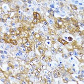 [KO Validated]Anti-ATG7 Antibody, clone 3X1W4, Rabbit Monoclonal