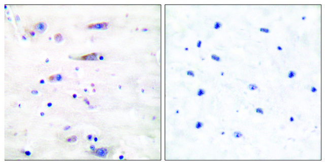 Anti-NMDAR1 antibody produced in rabbit affinity isolated antibody
