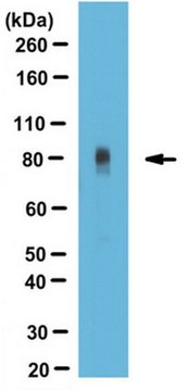 Anti-Periostin Antibody (C-term) 1&#160;mg/mL, from rabbit