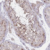 Anti-MIA3 antibody produced in rabbit Prestige Antibodies&#174; Powered by Atlas Antibodies, affinity isolated antibody, buffered aqueous glycerol solution