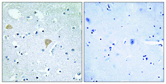 Anti-CTRO antibody produced in rabbit affinity isolated antibody