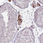 Anti-SLC15A3 antibody produced in rabbit Prestige Antibodies&#174; Powered by Atlas Antibodies, affinity isolated antibody, buffered aqueous glycerol solution