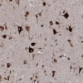 Anti-EPDR1 antibody produced in rabbit Prestige Antibodies&#174; Powered by Atlas Antibodies, affinity isolated antibody, buffered aqueous glycerol solution