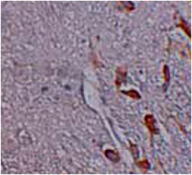 Anti-LRRTM1 Antibody from rabbit, purified by affinity chromatography