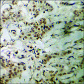 Anti-phospho-FOXO1A (pSer329) antibody produced in rabbit affinity isolated antibody