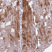 Anti-GABARAPL1 antibody produced in rabbit Prestige Antibodies&#174; Powered by Atlas Antibodies, affinity isolated antibody, buffered aqueous glycerol solution