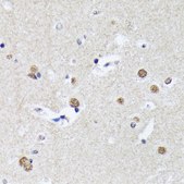 Anti-Matrin 3 antibody produced in rabbit