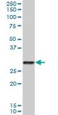 Anti-PRSS2 antibody produced in mouse IgG fraction of antiserum, buffered aqueous solution