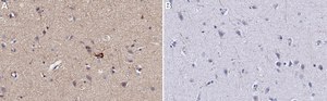 Anti-PTEN Antibody, clone A2b1 ZooMAb&#174; Mouse Monoclonal recombinant, expressed in HEK 293 cells