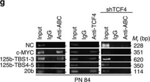 Anti-TCF-4 Antibody, clone 6H5-3 clone 6H5-3, Upstate&#174;, from mouse