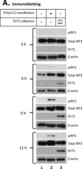 Anti-Enterovirus 71 Antibody, cross-reacts with Coxsackie A16, clone 422-8D-4C-4D ascites fluid, clone 422-8D-4C-4D, Chemicon&#174;