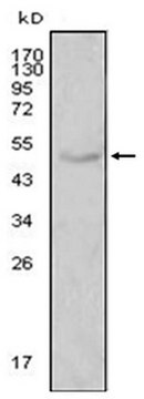 Anti-LPL Antibody, clone 2C5 ascites fluid, clone 2C5, from mouse