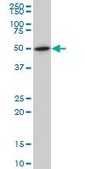 Monoclonal Anti-NR1H2 antibody produced in mouse clone 1E1, purified immunoglobulin, buffered aqueous solution