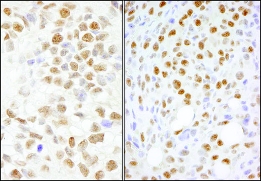 Rabbit anti-NONO Antibody, Affinity Purified Powered by Bethyl Laboratories, Inc.