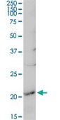 Anti-RGS5 antibody produced in rabbit purified immunoglobulin, buffered aqueous solution
