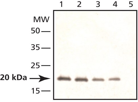 Anti-Caveolin-2 antibody produced in rabbit ~1&#160;mg/mL, affinity isolated antibody, buffered aqueous solution, suitable for western blot: 1&#160;&#956;g/mL