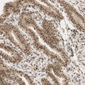 Anti-RNF113A antibody produced in rabbit Prestige Antibodies&#174; Powered by Atlas Antibodies, affinity isolated antibody, buffered aqueous glycerol solution