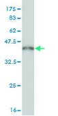 Monoclonal Anti-PDE5A antibody produced in mouse clone 9H5, purified immunoglobulin, buffered aqueous solution