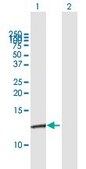 Anti-S100A10 antibody produced in mouse purified immunoglobulin, buffered aqueous solution