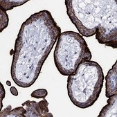 Anti-SDC1 antibody produced in rabbit Prestige Antibodies&#174; Powered by Atlas Antibodies, affinity isolated antibody, buffered aqueous glycerol solution