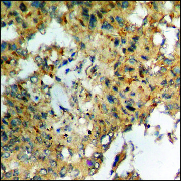 Anti-phospho-Tau (pSer404) antibody produced in rabbit affinity isolated antibody