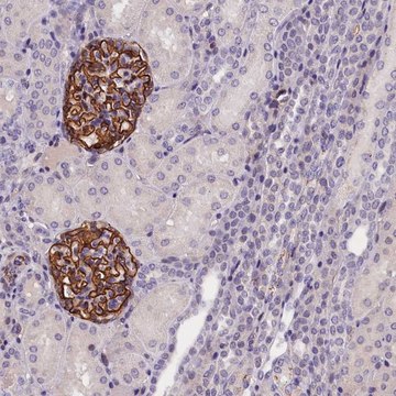 Anti-KLHL35 antibody produced in rabbit Prestige Antibodies&#174; Powered by Atlas Antibodies, affinity isolated antibody, buffered aqueous glycerol solution