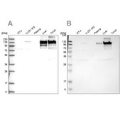 Anti-COL6A2 antibody produced in rabbit Prestige Antibodies&#174; Powered by Atlas Antibodies, affinity isolated antibody