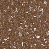 Anti-STXBP1 antibody produced in rabbit affinity isolated antibody, buffered aqueous glycerol solution