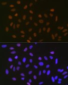 Anti-SUMO2/3 Antibody, clone 6R8G7, Rabbit Monoclonal