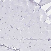 Anti-IL2RB antibody produced in rabbit Prestige Antibodies&#174; Powered by Atlas Antibodies, affinity isolated antibody, buffered aqueous glycerol solution