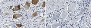 Anti-MRGPRX2 Antibody, clone 1O10 ZooMAb&#174; Rabbit Monoclonal recombinant, expressed in HEK 293 cells