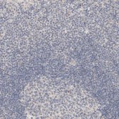 Anti-CA13 antibody produced in rabbit Prestige Antibodies&#174; Powered by Atlas Antibodies, affinity isolated antibody, buffered aqueous glycerol solution