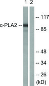Anti-C-PLA2 antibody produced in rabbit affinity isolated antibody