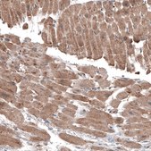 Monoclonal Anti-LAPTM4B antibody produced in mouse Prestige Antibodies&#174; Powered by Atlas Antibodies, clone CL5287, purified immunoglobulin, buffered aqueous glycerol solution
