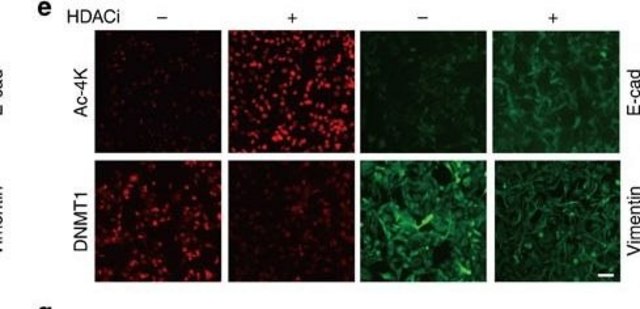 Monoclonal Anti-Vimentin antibody produced in mouse clone V9, ascites fluid