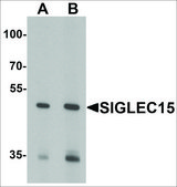 Anti-SIGLEC15 antibody produced in rabbit affinity isolated antibody