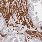 Anti-YAP1 antibody produced in rabbit Prestige Antibodies&#174; Powered by Atlas Antibodies, affinity isolated antibody, buffered aqueous glycerol solution