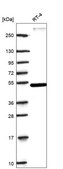 Anti-Rora Antibody Produced In Rabbit Prestige Antibodies&#174; Powered by Atlas Antibodies, affinity isolated antibody, buffered aqueous glycerol solution
