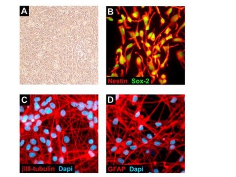 ReNcell VM Human Neural Progenitor Cell LIne ReNcell VM is an immortalized human neural progenitor cell line with the ability to readily differentiate into neurons &amp; glial cells.