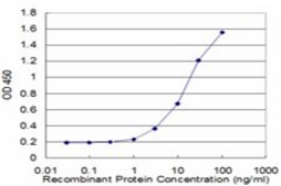 Monoclonal Anti-LIG4, (C-terminal) antibody produced in mouse clone 2D2, purified immunoglobulin, buffered aqueous solution