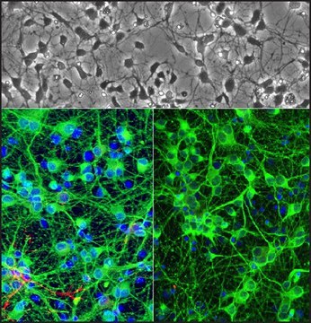 Rat Hippocampal Neurons: RHiN