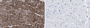 Anti-CACNA1C Antibody, clone 1F20 ZooMAb&#174; Rabbit Monoclonal recombinant, expressed in HEK 293 cells