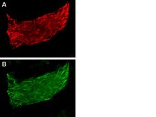 LentiBrite EB3-RFP Lentiviral Biosensor