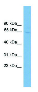 Anti-SLC6A2 antibody produced in rabbit affinity isolated antibody