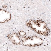 Monoclonal Anti-KLF4 antibody produced in mouse Prestige Antibodies&#174; Powered by Atlas Antibodies, clone CL5782, purified immunoglobulin, buffered aqueous glycerol solution