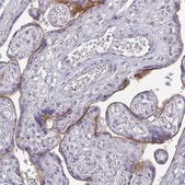 Monoclonal Anti-HER2 antibody produced in mouse Prestige Antibodies&#174; Powered by Atlas Antibodies, clone CL0268, purified immunoglobulin, buffered aqueous glycerol solution