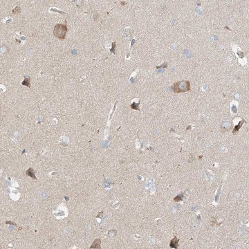 Anti-TSSC1 antibody produced in rabbit Prestige Antibodies&#174; Powered by Atlas Antibodies, affinity isolated antibody, buffered aqueous glycerol solution