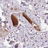 Anti-HRG antibody produced in rabbit Prestige Antibodies&#174; Powered by Atlas Antibodies, affinity isolated antibody, buffered aqueous glycerol solution