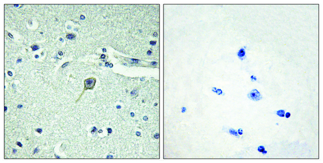 Anti-PTHR1 antibody produced in rabbit affinity isolated antibody