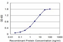 Monoclonal Anti-PTGIR, (C-terminal) antibody produced in mouse clone 2A7, purified immunoglobulin, buffered aqueous solution